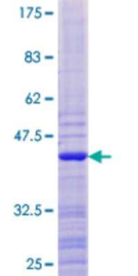 12.5% SDS-PAGE Stained with Coomassie Blue.