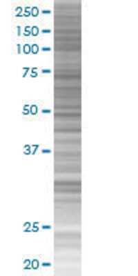 ZNF343 transfected lysate.