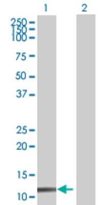 Lane 1: ZNF343 transfected lysate (13.09 KDa) Lane 2: Non-transfected lysate.