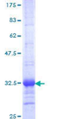 12.5% SDS-PAGE Stained with Coomassie Blue.