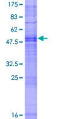 12.5% SDS-PAGE Stained with Coomassie Blue.