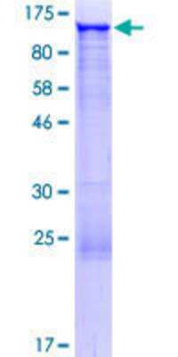 Other Recombinant Human GCC1 GST (N-Term) Protein