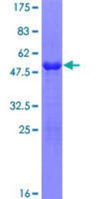 SDS-PAGE Recombinant Human SPAG16 GST (N-Term) Protein