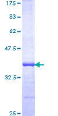 12.5% SDS-PAGE Stained with Coomassie Blue.
