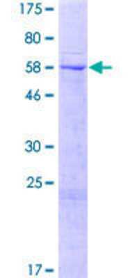 12.5% SDS-PAGE Stained with Coomassie Blue.