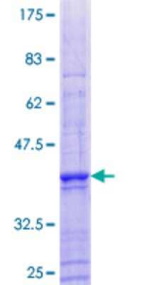 12.5% SDS-PAGE Stained with Coomassie Blue.