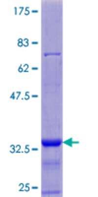 12.5% SDS-PAGE Stained with Coomassie Blue.