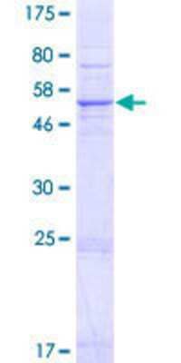 SDS-Page: Recombinant Human SRD5A3 Protein [H00079644-P01] - 12.5% SDS-PAGE Stained with Coomassie Blue.