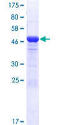 12.5% SDS-PAGE Stained with Coomassie Blue.
