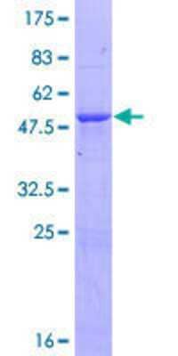 12.5% SDS-PAGE Stained with Coomassie Blue.