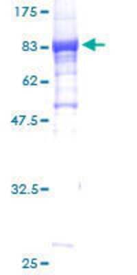 12.5% SDS-PAGE Stained with Coomassie Blue.
