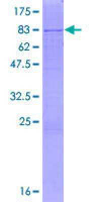 12.5% SDS-PAGE Stained with Coomassie Blue.