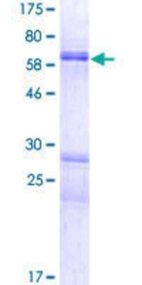 12.5% SDS-PAGE Stained with Coomassie Blue.