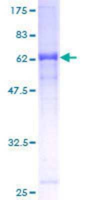 Other Recombinant Human ZYG11B GST (N-Term) Protein