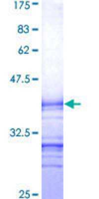 12.5% SDS-PAGE Stained with Coomassie Blue.