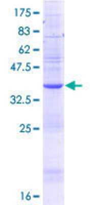Other Recombinant Human TBLR1 GST (N-Term) Protein