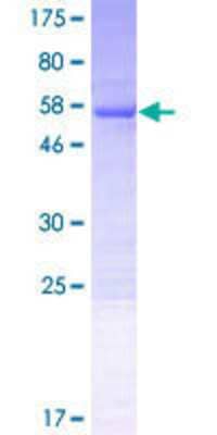 SDS-PAGE Recombinant Human VPS37B GST (N-Term) Protein