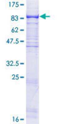 12.5% SDS-PAGE Stained with Coomassie Blue.