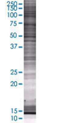 BBS10 transfected lysate.