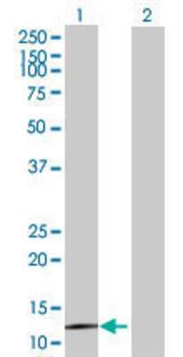 Lane 1: BBS10 transfected lysate (16.72 KDa) Lane 2: Non-transfected lysate.