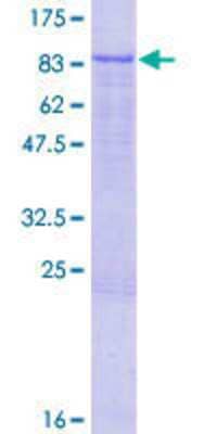 12.5% SDS-PAGE Stained with Coomassie Blue.