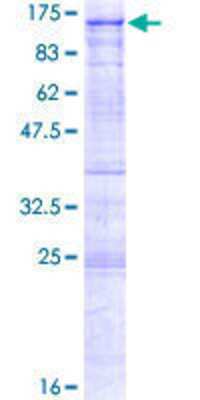 Other Recombinant Human ALS2CR8 GST (N-Term) Protein