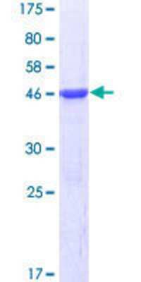 12.5% SDS-PAGE Stained with Coomassie Blue.