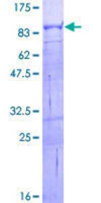12.5% SDS-PAGE Stained with Coomassie Blue.