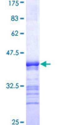 Other Recombinant Human PEAK1 GST (N-Term) Protein