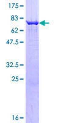 Other Recombinant Human PIP5K2 gamma GST (N-Term) Protein