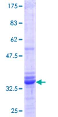 12.5% SDS-PAGE Stained with Coomassie Blue.