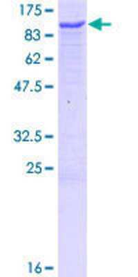12.5% SDS-PAGE Stained with Coomassie Blue.