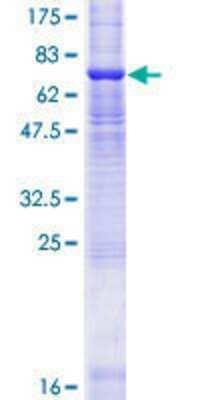 12.5% SDS-PAGE Stained with Coomassie Blue.