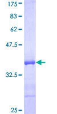 12.5% SDS-PAGE Stained with Coomassie Blue.