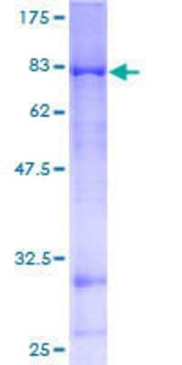 12.5% SDS-PAGE Stained with Coomassie Blue.