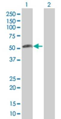 Lane 1: C18orf22 transfected lysate (37.84 KDa). Lane 2: Non-transfected lysate.
