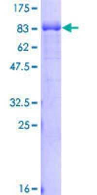 12.5% SDS-PAGE Stained with Coomassie Blue.