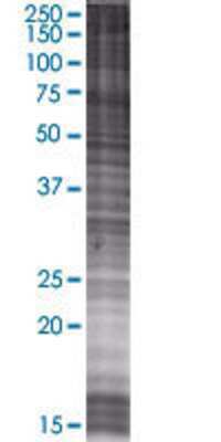 RABEP2 transfected lysate.