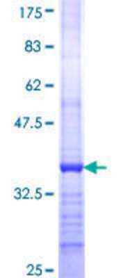 12.5% SDS-PAGE Stained with Coomassie Blue.