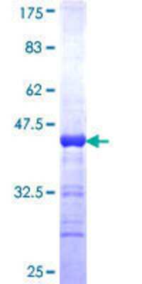 SDS-Page: Recombinant Human RIN3 Protein [H00079890-Q01] - 12.5% SDS-PAGE Stained with Coomassie Blue.