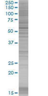 ZNF671 transfected lysate.