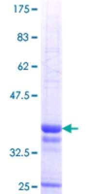 12.5% SDS-PAGE Stained with Coomassie Blue.