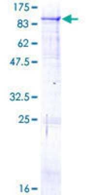 12.5% SDS-PAGE Stained with Coomassie Blue.