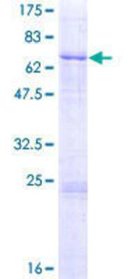 12.5% SDS-PAGE Stained with Coomassie Blue.