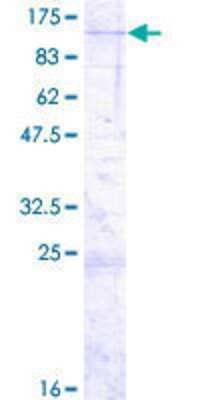 12.5% SDS-PAGE Stained with Coomassie Blue.