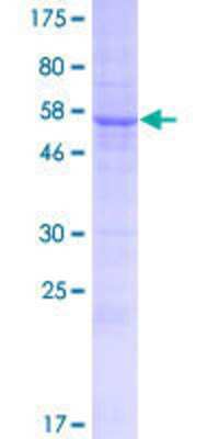 Other Recombinant Human ERMP1 GST (N-Term) Protein