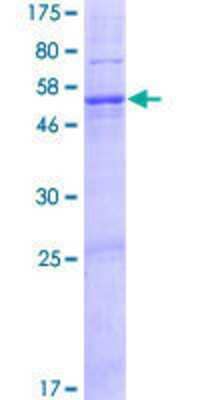 12.5% SDS-PAGE Stained with Coomassie Blue.