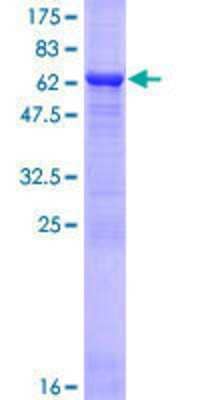 12.5% SDS-PAGE Stained with Coomassie Blue.