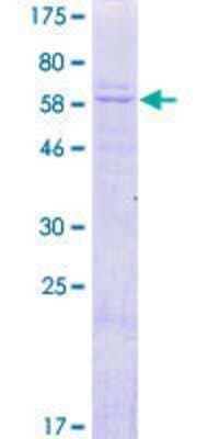 12.5% SDS-PAGE Stained with Coomassie Blue.