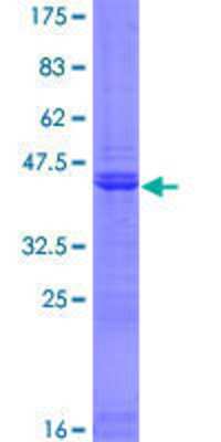 SDS-Page: Recombinant Human PHC3 Protein [H00080012-P01] - 12.5% SDS-PAGE Stained with Coomassie Blue.